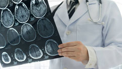 Brain Health Nutrition – The Alzheimer’s Dementia Sub-Types a la the ReCODE 2.0 Protocol
