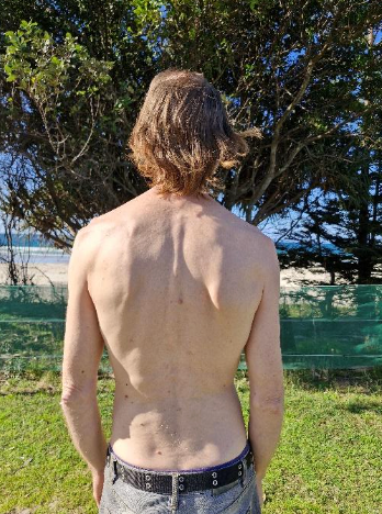 Shirtless person with long hair stands facing trees at a beach. Blue sky and green foliage create a serene, relaxed mood.