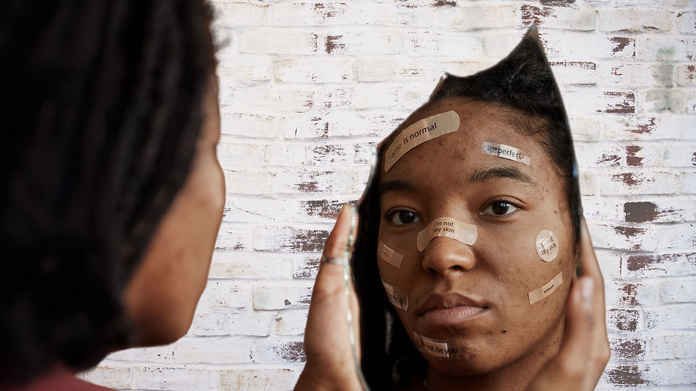 Person holds a mirror, reflecting their face with acne patches labeled "acne is normal," "imperfect," and "be you." Background: white brick wall.