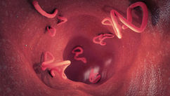 Could Parasites Be Negatively Affecting Your Health?