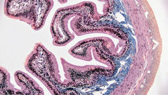 Are Parasite Cleanses Safe? What to Do and Not Do Before Starting Any Parasite Cleanse