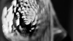 The Day I Lost My Face Forever