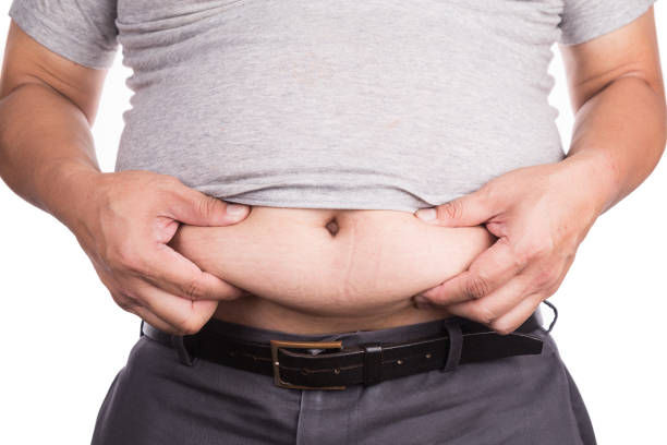 Close-up of man holding unhealthy big belly with visceral and subcutaneous fats.