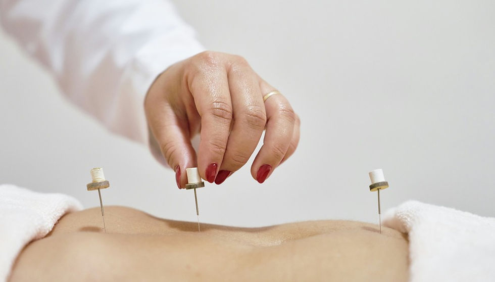 Woman’s hand with red nails placing acupuncture needles into a bare back in a calm spa setting.