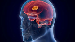 Four Household Hygiene Hacks for Brain Health
