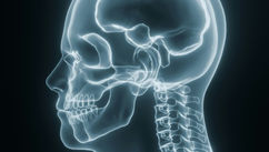Craniocervical Instability, Ehlers-Danlos Syndrome, and the Hidden Mental Health Burden